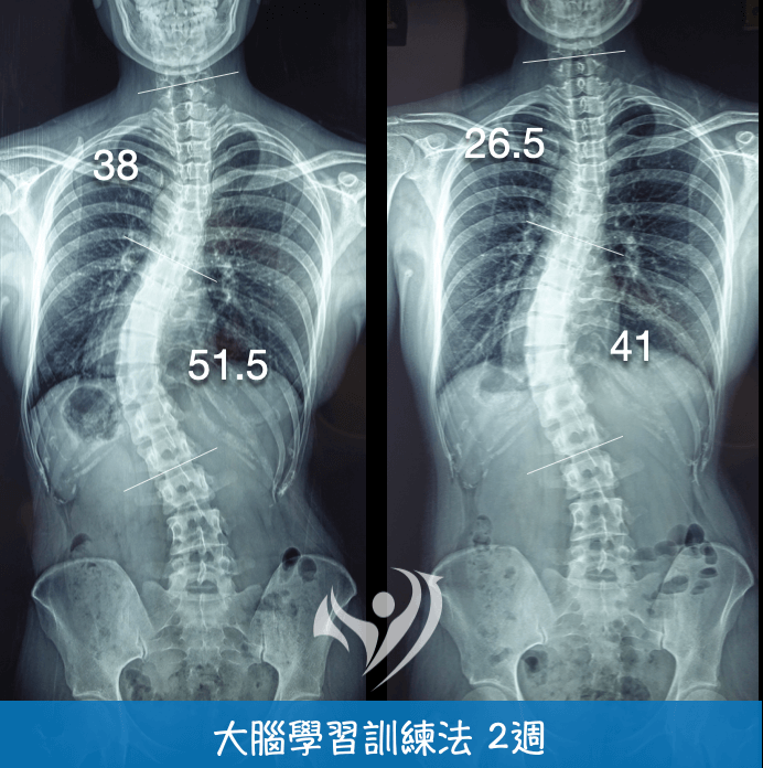 22歲2週密集訓練51.5度降到41度