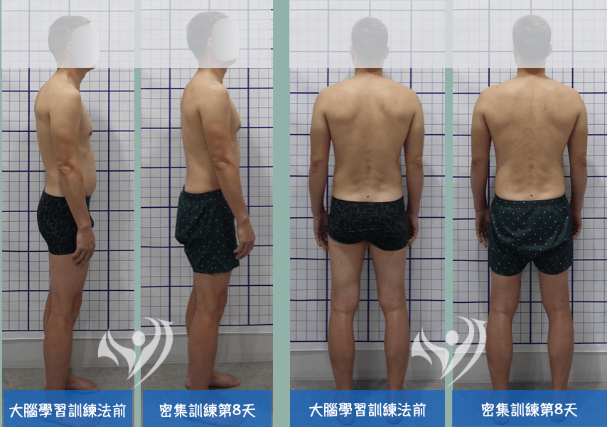 大腦學習訓練法8天改善中年駝背問題